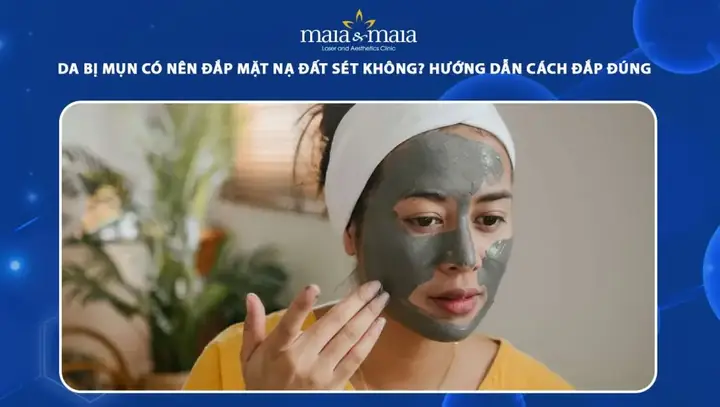 Da Mụn Có Nên Dùng Mặt Nạ Đất Sét Không? Hướng Dẫn Chi Tiết Từ Chuyên Gia