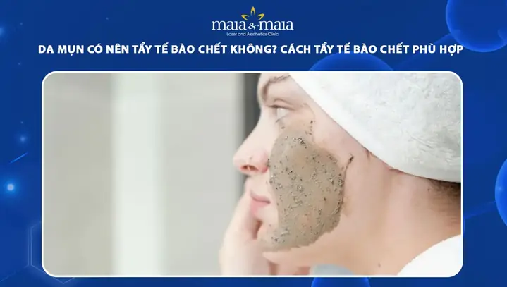 Da Mụn Có Nên Tẩy Tế Bào Chết Không? Hướng Dẫn Lựa Chọn Và Cách Thực Hiện An Toàn Da Mụn Có Nên Tẩy Tế Bào Chết Không? Hướng Dẫn Lựa Chọn Và Cách Thực Hiện An Toàn