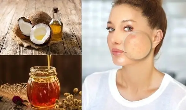 Bí Quyết Đắp Mặt Nạ Dầu Dừa: Dưỡng Sáng, Trị Mụn & Nuôi Dưỡng Da Sáng Mịn Tự Nhiên