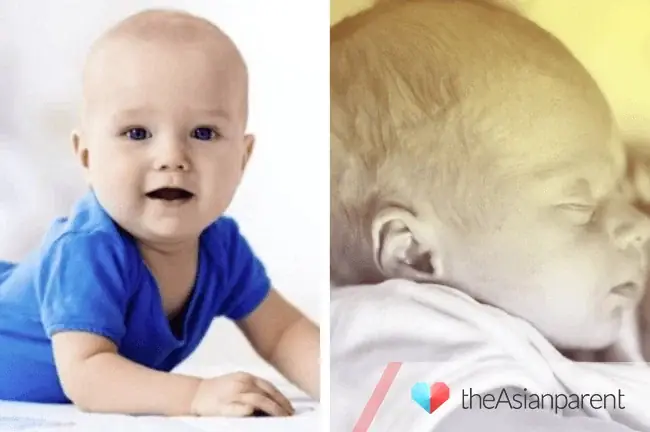 Đầu Em Bé Sơ Sinh Bị Dài: Nguyên Nhân, Ảnh Hưởng Và Cách Xử Lý Toàn Diện Đầu Em Bé Sơ Sinh Bị Dài: Nguyên Nhân, Ảnh Hưởng Và Cách Xử Lý Toàn Diện