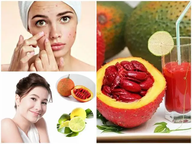 Dầu Gấc Có Tốt Cho Da Mụn Không? Hiệu Quả Và Cách Sử Dụng Đúng Chuẩn