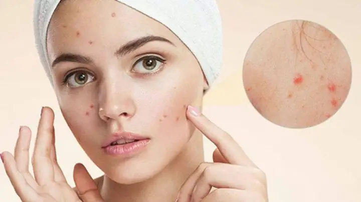 Dấu Hiệu Nhận Biết Da Không Hợp Mỹ Phẩm & Cách Xử Lý Kịp Thời
