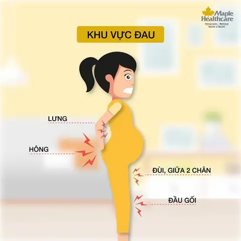 Dấu Hiệu Đau Lưng Khi Mang Thai Tháng Đầu: Nguyên Nhân, Cách Xử Lý An Toàn Cho Mẹ Bầu