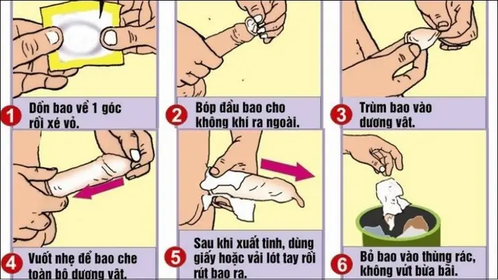 Dùng Bao Cao Su Vẫn Có Thai: Nguyên Nhân, Cách Phòng Tránh Tối Đa Nguy Cơ