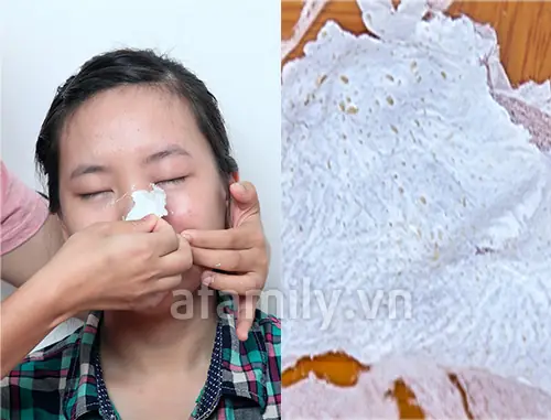 Gel Lột Mụn Titione Có Tốt Không? Đánh Giá Chi Tiết & Sự Thật Cần Biết Gel Lột Mụn Titione Có Tốt Không? Đánh Giá Chi Tiết & Sự Thật Cần Biết