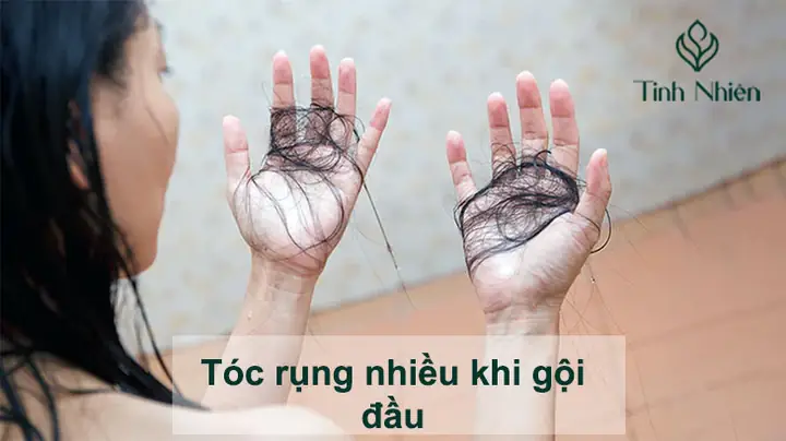 Tóc Rụng Nhiều Khi Gội Đầu: Nguyên Nhân, Cách Khắc Phục Toàn Diện & Phòng Tránh Hiệu Quả