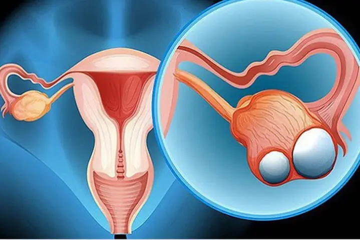 Hcg Dương Tính Nhưng Không Có Thai: Nguyên Nhân, Dấu Hiệu Và Cách Xử Lý Hcg Dương Tính Nhưng Không Có Thai: Nguyên Nhân, Dấu Hiệu Và Cách Xử Lý