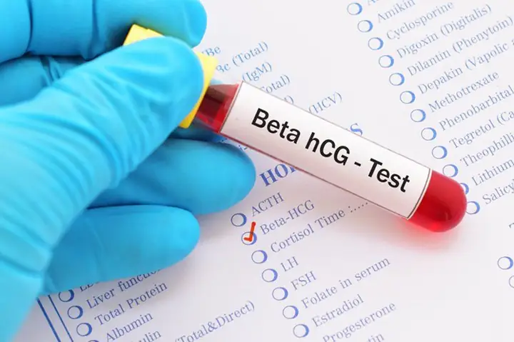 Hcg Dương Tính Nhưng Không Có Thai: Nguyên Nhân, Dấu Hiệu Và Cách Xử Lý Hcg Dương Tính Nhưng Không Có Thai: Nguyên Nhân, Dấu Hiệu Và Cách Xử Lý