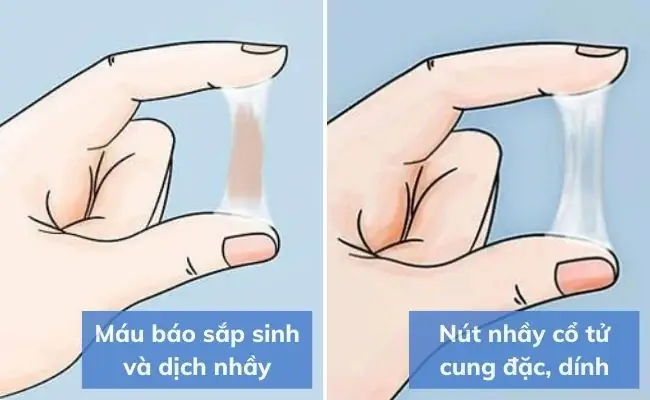 Ra Máu Báo Khi Sắp Sinh: Dấu Hiệu, Thời Điểm Và Những Điều Cần Biết