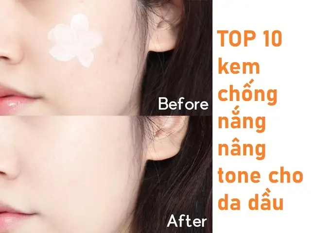 Top Kem Chống Nắng Nâng Tone Cho Da Mụn: Lựa Chọn Hiệu Quả, An Toàn, Kiềm Dầu Tốt Nhất 2026