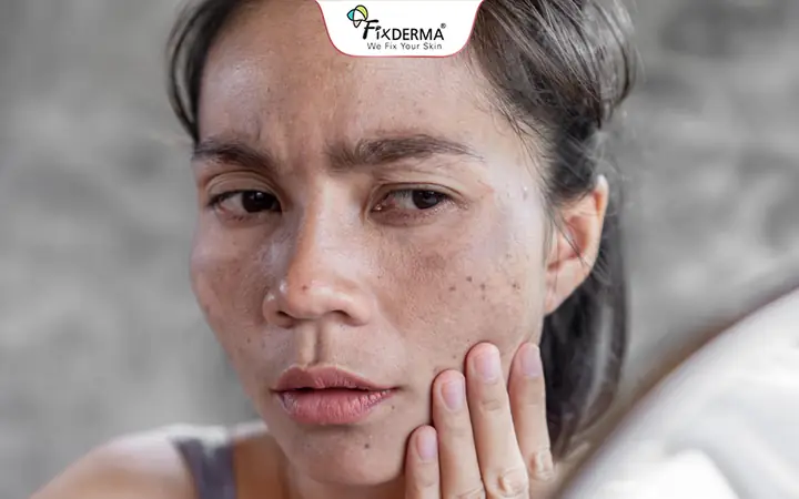 Kem Chống Nắng Có Thực Sự Chống Đen Da Không? Nguyên Nhân Và Cách Khắc Phục Hiệu Quả