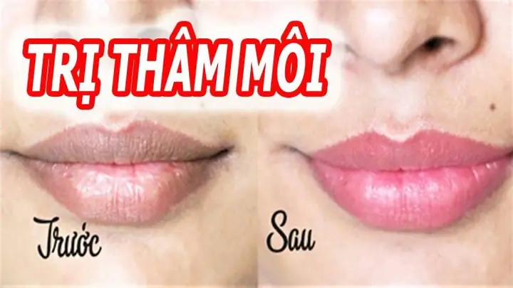 Kem Đánh Răng Có Trị Thâm Môi Không? Sự Thật Và Cách Sử Dụng An Toàn