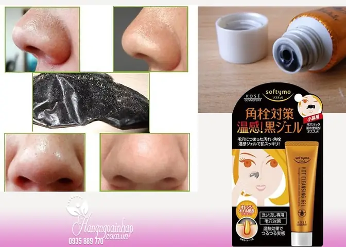 Kem Lột Mụn Đầu Đen Hiệu Quả: Top Sản Phẩm & Cách Lột Mụn An Toàn Tại Nhà