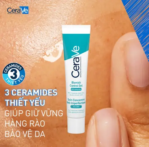 Top 10+ Kem Trị Mụn Rẻ Tiền Hiệu Quả Nhất 2026: Làn Da Sạch Mụn Không Lo Về Giá Top 10+ Kem Trị Mụn Rẻ Tiền Hiệu Quả Nhất 2026: Làn Da Sạch Mụn Không Lo Về Giá