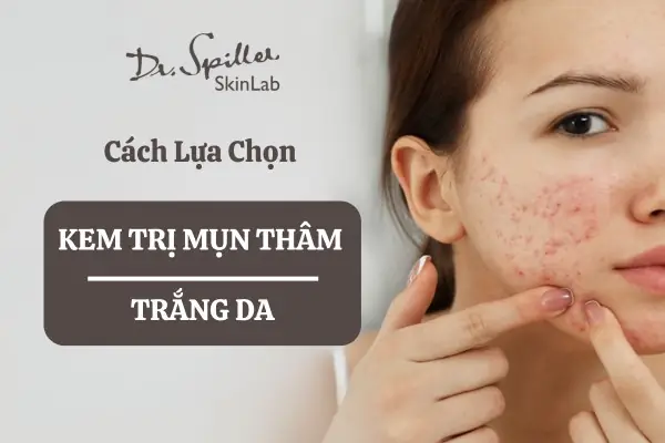 Top Kem Trị Mụn Trắng Da Hiệu Quả Nhất: Lựa Chọn Hoàn Hảo Cho Làn Da Rạng Ngời Top Kem Trị Mụn Trắng Da Hiệu Quả Nhất: Lựa Chọn Hoàn Hảo Cho Làn Da Rạng Ngời
