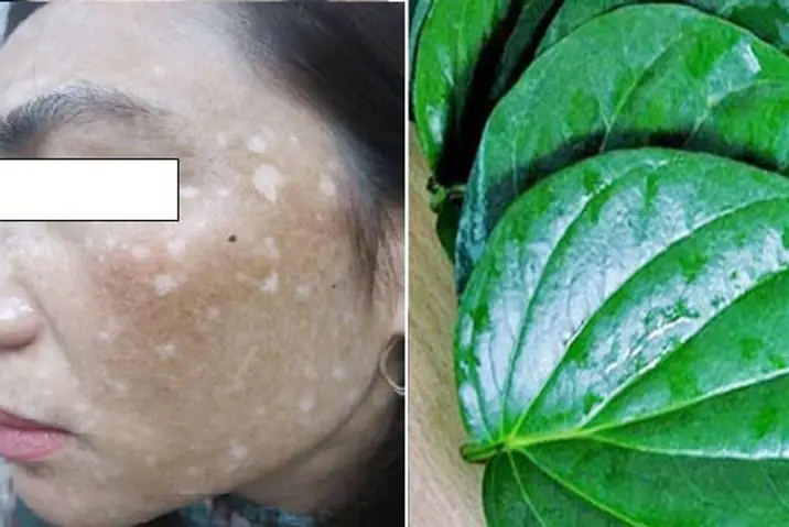 Lá Trầu Không: Bí Quyết Làm Đẹp Da Tự Nhiên Được Phái Đẹp Săn Đón Lá Trầu Không: Bí Quyết Làm Đẹp Da Tự Nhiên Được Phái Đẹp Săn Đón