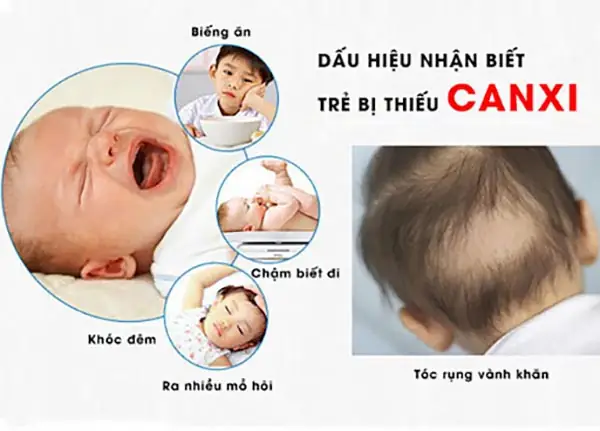 Nhận Biết Sớm Dấu Hiệu Trẻ Thiếu Canxi: Hướng Dẫn Chi Tiết Cho Cha Mẹ Nhận Biết Sớm Dấu Hiệu Trẻ Thiếu Canxi: Hướng Dẫn Chi Tiết Cho Cha Mẹ