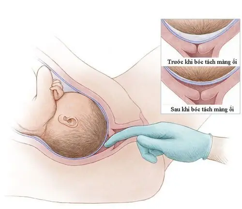 Làm Sao Để Kích Thích Sinh Sớm An Toàn Và Hiệu Quả?