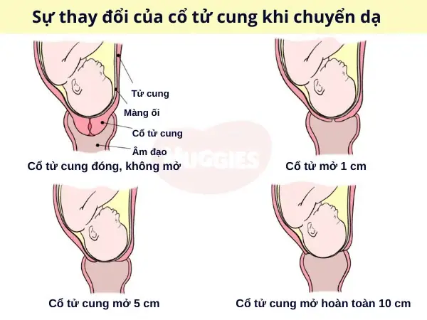 Cơn Chuyển Dạ Sắp Đến: Bí Quyết Giúp Mẹ Bầu Kích Thích Chuyển Dạ Tự Nhiên & An Toàn Cơn Chuyển Dạ Sắp Đến: Bí Quyết Giúp Mẹ Bầu Kích Thích Chuyển Dạ Tự Nhiên & An Toàn