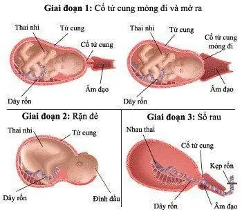 Cơn Chuyển Dạ Sắp Đến: Bí Quyết Giúp Mẹ Bầu Kích Thích Chuyển Dạ Tự Nhiên & An Toàn Cơn Chuyển Dạ Sắp Đến: Bí Quyết Giúp Mẹ Bầu Kích Thích Chuyển Dạ Tự Nhiên & An Toàn
