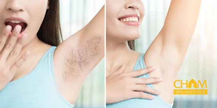Top 7+ Cách Triệt Lông Nách Tại Nhà Hiệu Quả, An Toàn & Tự Nhiên Nhất 2024