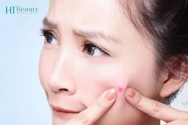 8+ Bí Kíp An Toàn: Cách Làm Trắng Da Tuổi Dậy Thì Hiệu Quả & Tự Nhiên