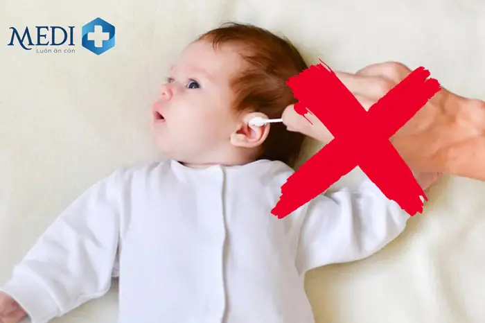 Lấy Ráy Tai Khô Cho Bé An Toàn: Hướng Dẫn Chi Tiết & Phương Pháp Hiệu Quả Từ Chuyên Gia