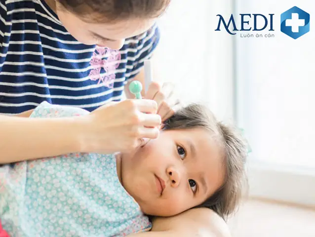 Lấy Ráy Tai Khô Cho Bé An Toàn: Hướng Dẫn Chi Tiết & Phương Pháp Hiệu Quả Từ Chuyên Gia