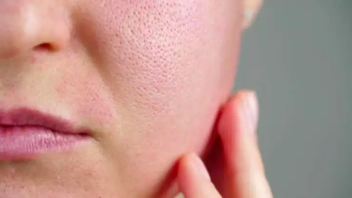 Lông Mặt Nhiều Có Nên Cạo Không? Lợi Ích, Rủi Ro & Lời Khuyên Từ Chuyên Gia Lông Mặt Nhiều Có Nên Cạo Không? Lợi Ích, Rủi Ro & Lời Khuyên Từ Chuyên Gia