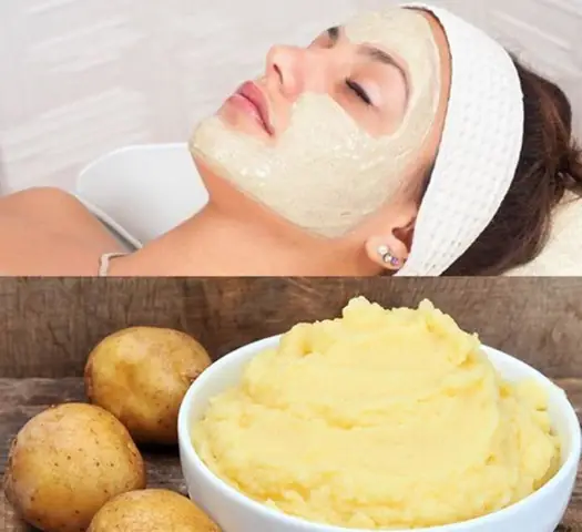 Mặt Nạ Khoai Tây Trị Thâm Mụn: Công Thức Đơn Giản, Hiệu Quả Tại Nhà