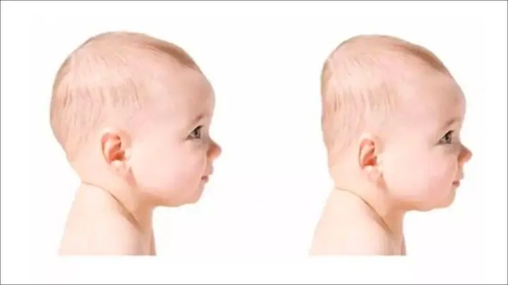 Mẹo Dân Gian Giúp Đầu Bé Tròn Đều: Hướng Dẫn Chi Tiết Từ Chuyên Gia
