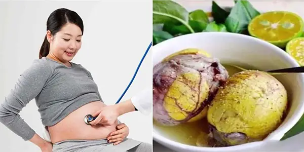 Bà Bầu Có Nên Ăn Hột Vịt Lộn Không? Lợi Ích, Rủi Ro Và Lưu Ý Quan Trọng