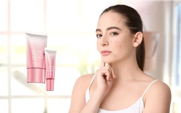 Mới Nặn Mụn Xong Có Nên Bôi Kem Chống Nắng Không? Lời Khuyên Chuyên Gia