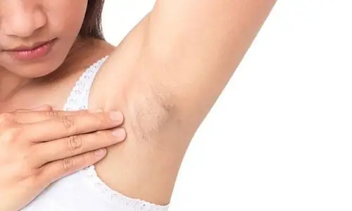 Nách Thâm Đen Khi Mang Thai: Nguyên Nhân, Dấu Hiệu & Cách Xử Lý An Toàn Cho Mẹ Bầu