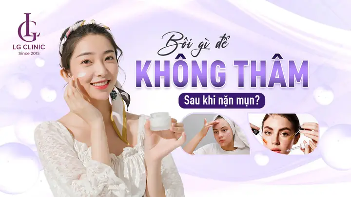 Nặn Mụn Xong Bôi Gì Để Không Bị Thâm Sẹo Hiệu Quả? Nặn Mụn Xong Bôi Gì Để Không Bị Thâm Sẹo Hiệu Quả?