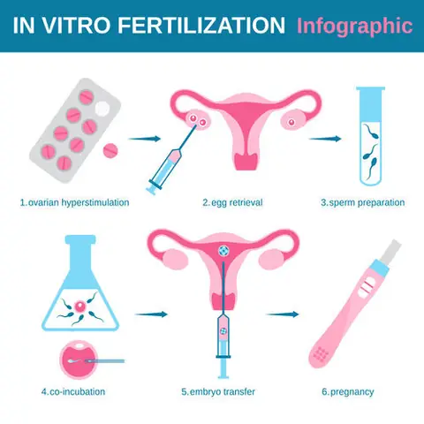 Nên Làm Thụ Tinh Ống Nghiệm (ivf) Ở Bệnh Viện Nào Tốt Nhất Tại Việt Nam?