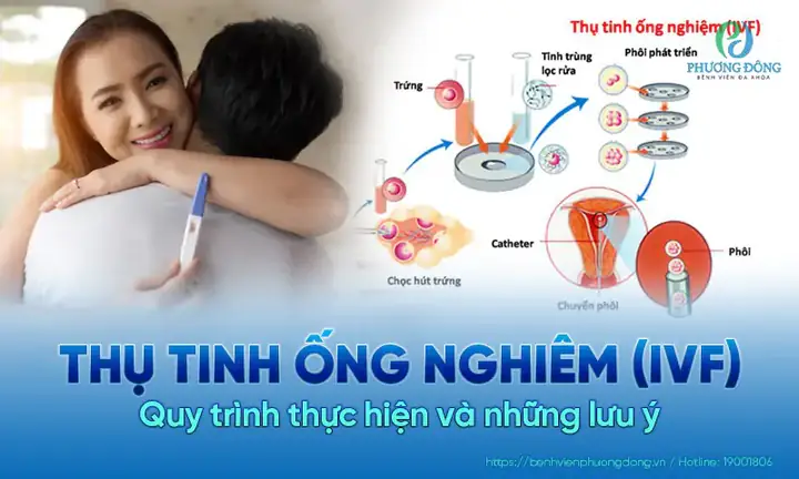 Nên Làm Thụ Tinh Ống Nghiệm (ivf) Ở Bệnh Viện Nào Tốt Nhất Tại Việt Nam?