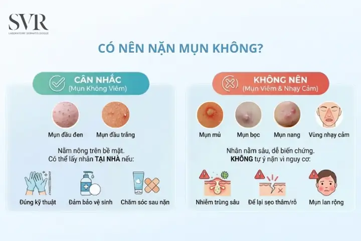 Thời Điểm Vàng Để Nặn Mụn: Khi Nào Nên Nặn Và Cách Nặn Đúng Chuẩn, Tránh Thâm Sẹo Thời Điểm Vàng Để Nặn Mụn: Khi Nào Nên Nặn Và Cách Nặn Đúng Chuẩn, Tránh Thâm Sẹo