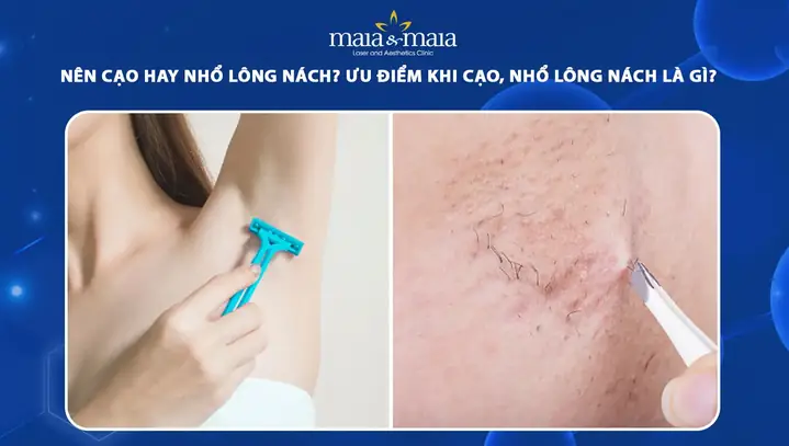 Nên Nhổ Hay Cạo Lông Nách: Đâu Là Lựa Chọn Tốt Nhất Cho Bạn?