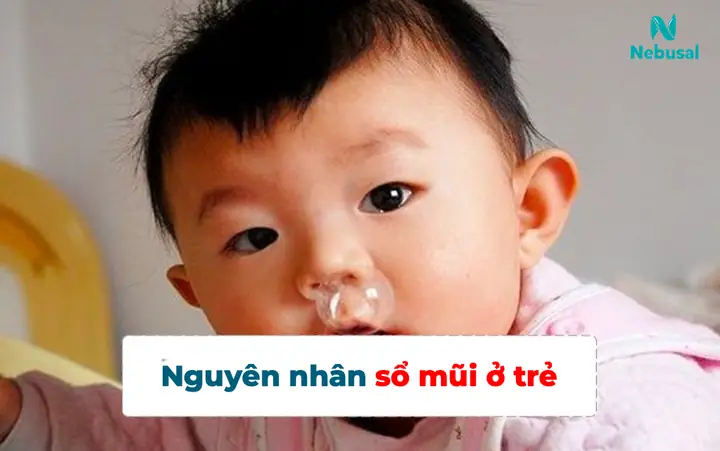 Nguyên Nhân Trẻ Bị Sổ Mũi Kéo Dài: Tất Tần Tật Từ A-z Cho Cha Mẹ