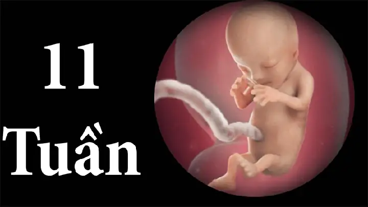 Nhịp Tim Thai Nhi Tuần 11: Chỉ Số Chuẩn, Dấu Hiệu Bất Thường & Lời Khuyên Từ Chuyên Gia Nhịp Tim Thai Nhi Tuần 11: Chỉ Số Chuẩn, Dấu Hiệu Bất Thường & Lời Khuyên Từ Chuyên Gia