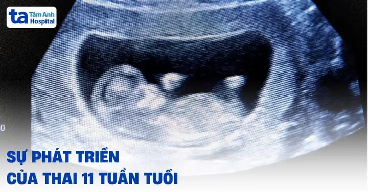 Nhịp Tim Thai Nhi Tuần 11: Chỉ Số Chuẩn, Dấu Hiệu Bất Thường & Lời Khuyên Từ Chuyên Gia Nhịp Tim Thai Nhi Tuần 11: Chỉ Số Chuẩn, Dấu Hiệu Bất Thường & Lời Khuyên Từ Chuyên Gia