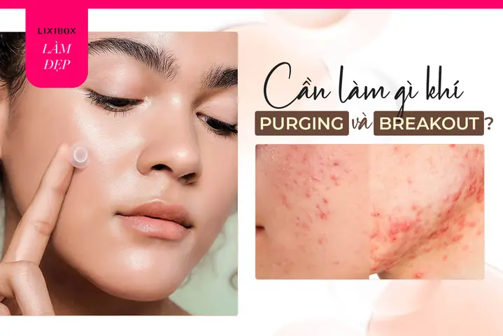 Phân Biệt Purging Và Breakout: Dấu Hiệu, Nguyên Nhân & Cách Xử Lý Hiệu Quả