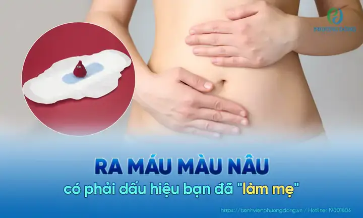 Ra Khí Hư Màu Nâu Có Phải Dấu Hiệu Mang Thai Sớm Không? Giải Đáp Chi Tiết