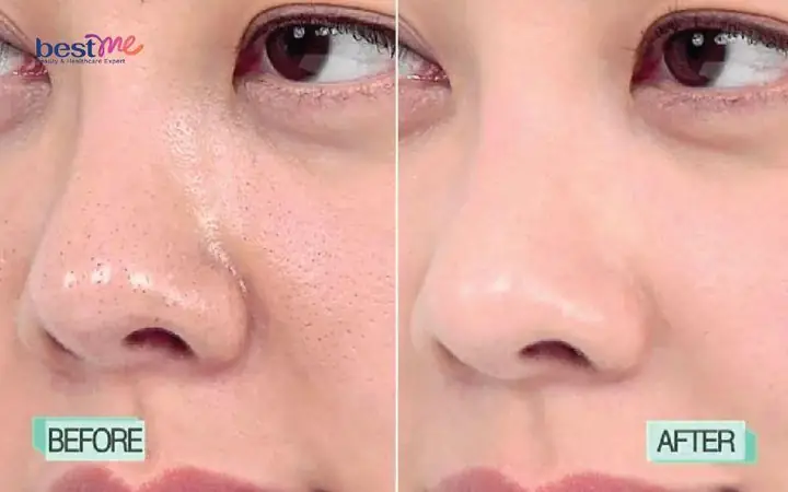 Review Sản Phẩm Se Khít Lỗ Chân Lông: Bí Quyết Sở Hữu Làn Da Mịn Màng, Không Tì Vết