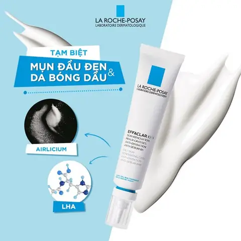 Review Sản Phẩm Trị Mụn Đầu Đen Hiệu Quả Tốt Nhất 2026: Chọn Đúng Sản Phẩm Cho Làn Da Sáng Mịn