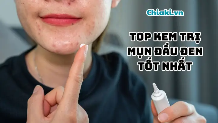 Review Sản Phẩm Trị Mụn Đầu Đen Hiệu Quả Tốt Nhất 2026: Chọn Đúng Sản Phẩm Cho Làn Da Sáng Mịn
