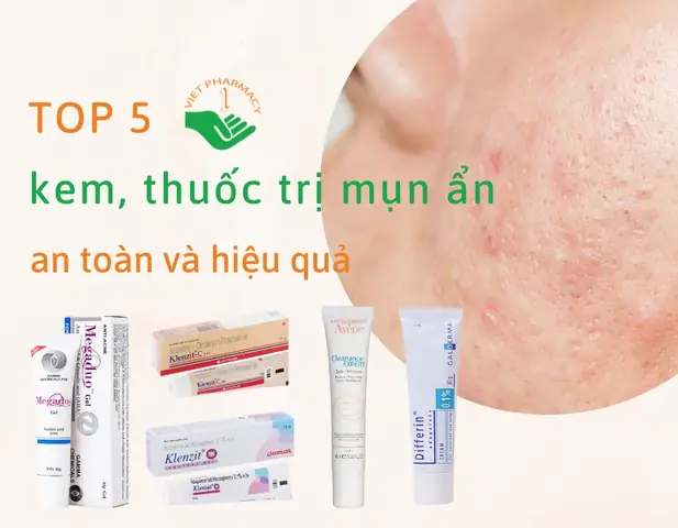 Top Sản Phẩm Trị Mụn Ẩn Tốt Nhất: Đánh Giá Toàn Diện & Lựa Chọn Phù Hợp