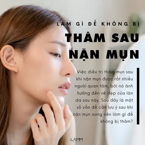 Chăm Sóc Da Sau Khi Lột Mụn: Bí Quyết Phục Hồi & Ngăn Ngừa Thâm Sẹo Hiệu Quả
