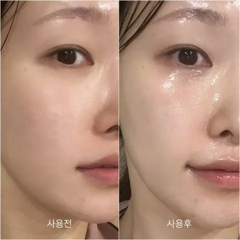 Serum Dùng Trước Hay Sau Kem Dưỡng: Thứ Tự Skincare Tối Ưu Cho Làn Da